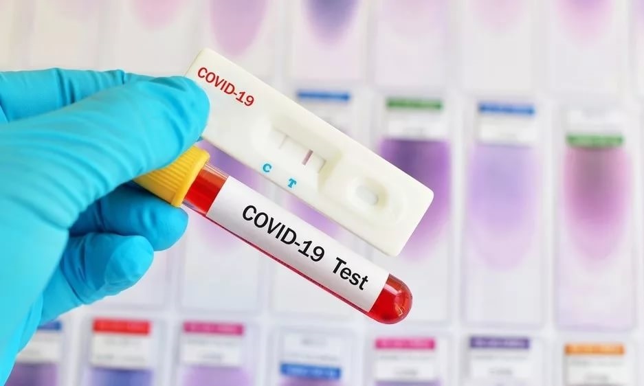 Анализ на коронавирус