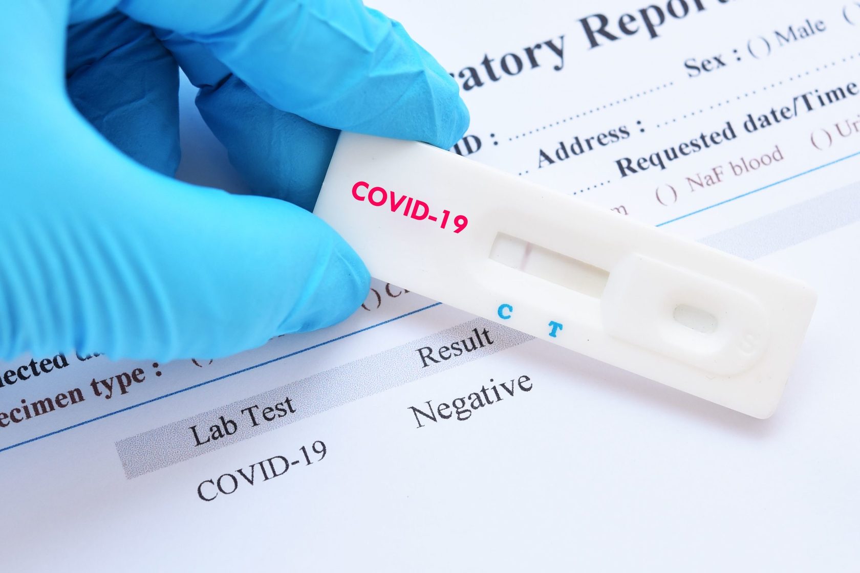 Тест на антитела к коронавирусу в Первом клиническом медицинском центре